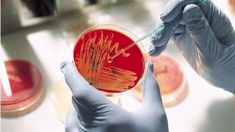 cultivo bacteriano para la prostatitis para prescribir antibióticos