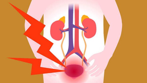 dolor en el área de la vejiga con prostatitis aguda